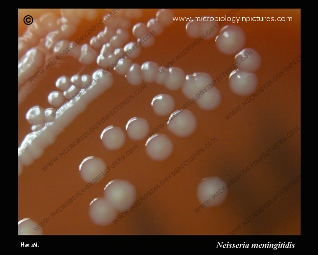 Neisseria meningitidis colonies on blood agar neisseria meningitidis colonies on sheep blood agar